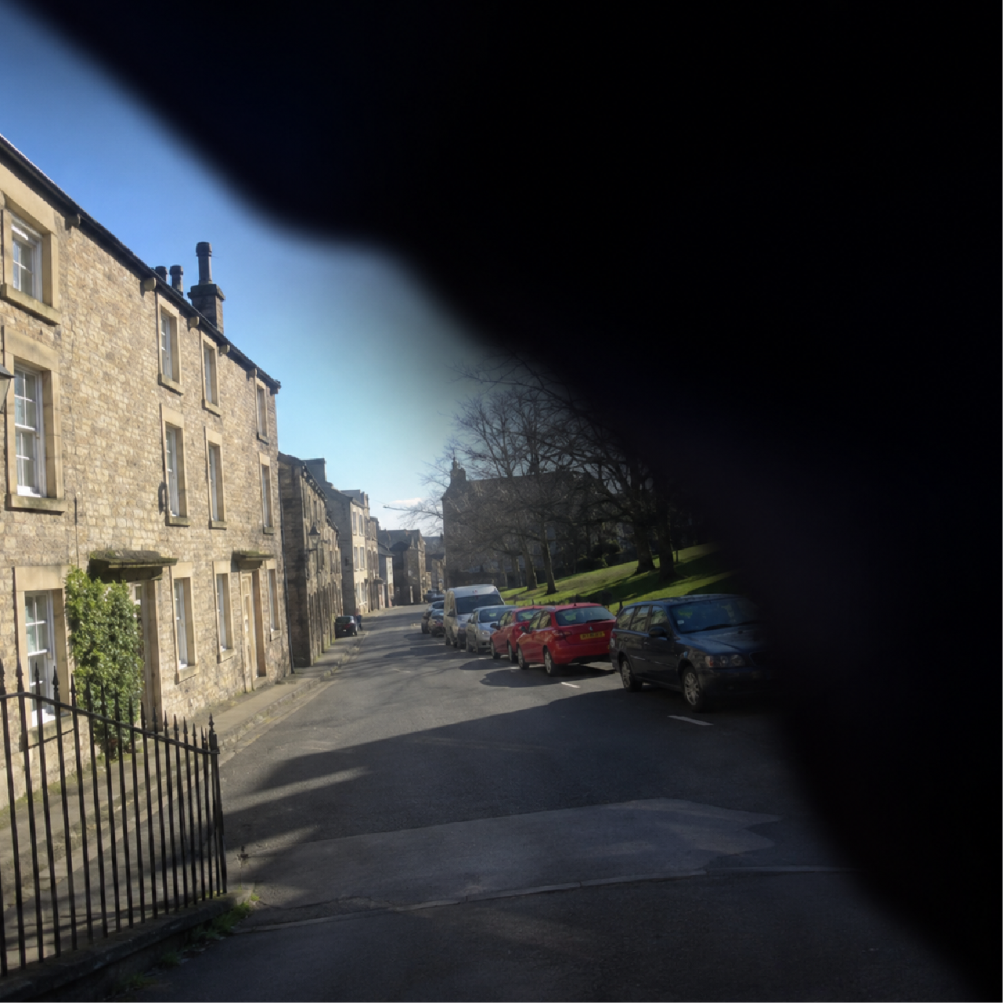 Retinal Tears Or Detachments